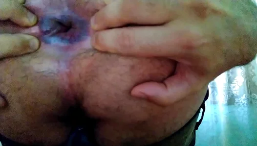 Close–Up View Of Amateur Twink 18+'s Big Ass InGay Anal Action