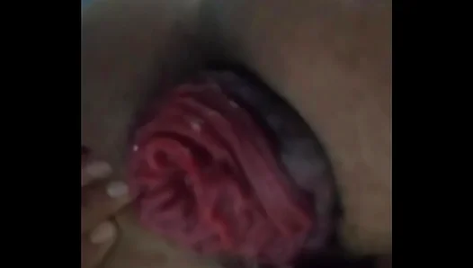 Extreme Anal Prolapse – Intense Gay Sex Pushing Limits