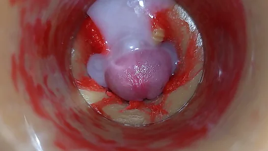 Camera Inside Deep Pussy Captures Very Huge Ejaculation of Sperm ASMR